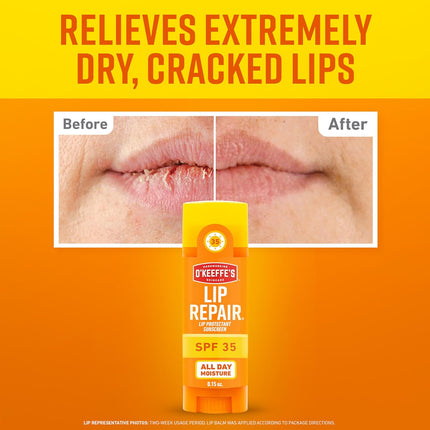 Lip Repair SPF 35 Lip Balm - Stick (3 Pack) - Sun-Safe Moisturizer for Extremely Cracked, Dry Lips